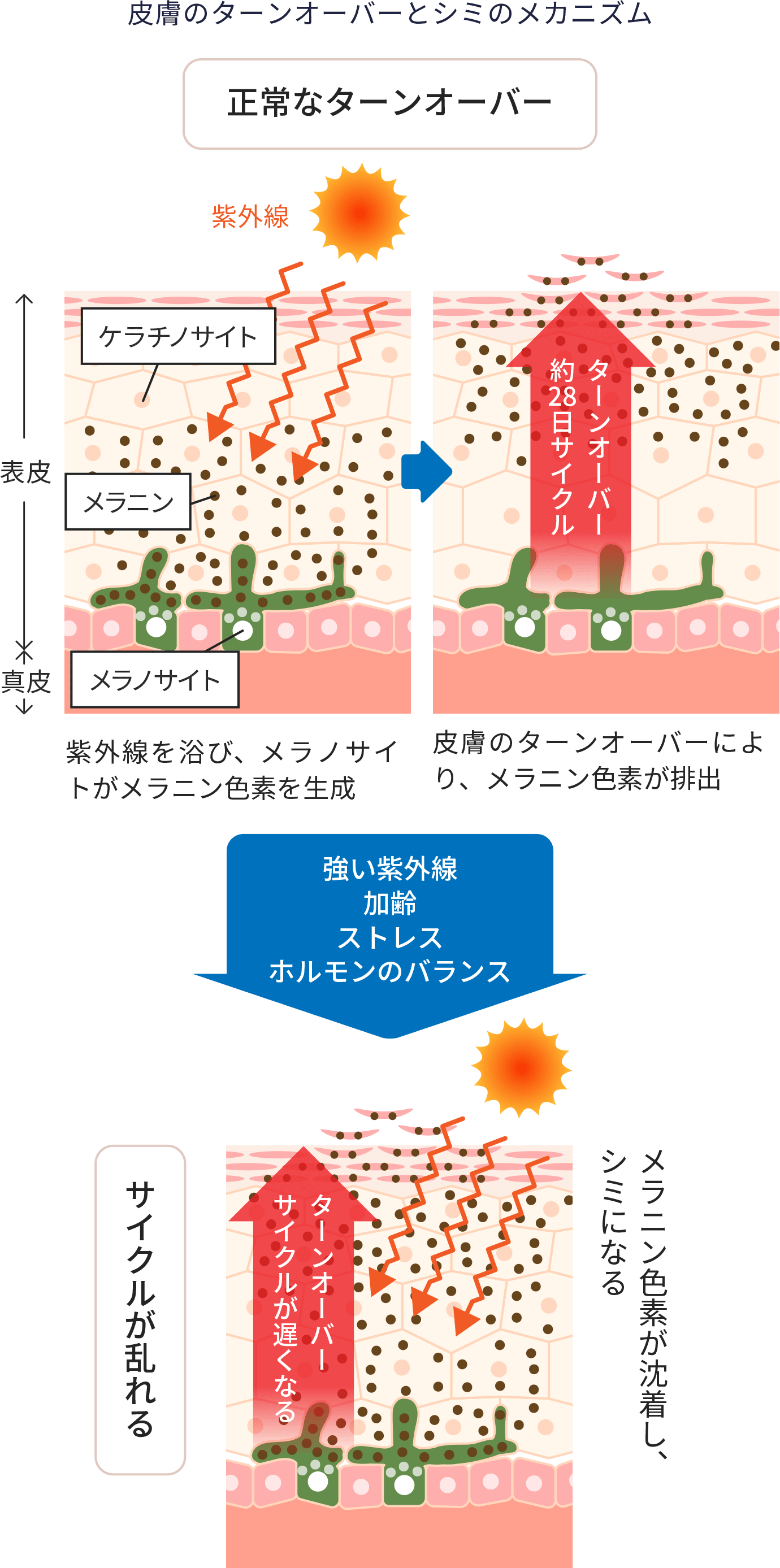 皮膚のターンオーバーとシミのメカニズム